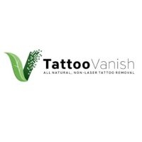 Business Listing Tattoo Vanish in Hialeah FL
