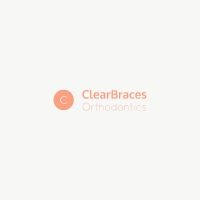 Clear Braces Orthodontics