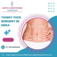 Cheap Cost of Tummy Tuck Surgery In India