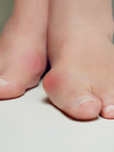 Business Listing Plantar Wart Growing Perth Amboy, NJ in Perth Amboy NJ